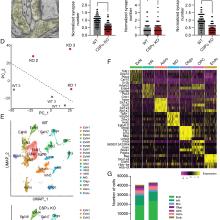 Decoding transcriptomic signatures of cysteine string protein alpha–mediated synapse maintenanc