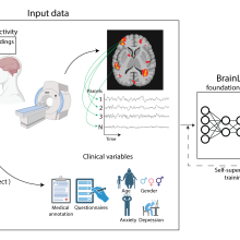 BrainLM